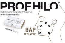 Offers-gallery/prophilo1